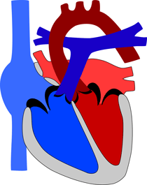 Persistierendes Foramen ovale